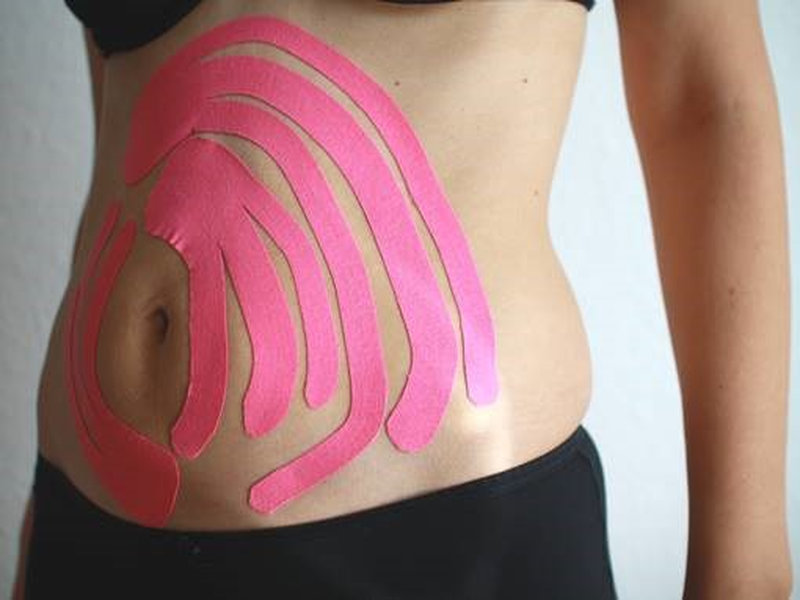 ®Ute Steinhoff Kinesiotaping in der schwangerschaft und rueckbildungszeit