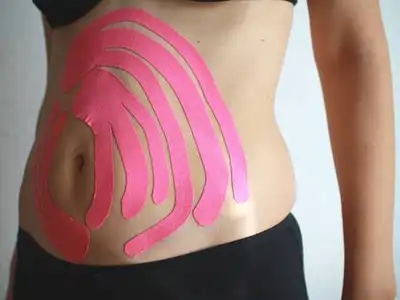Bauch mit mehreren pinkfarbenen Kinesiotape-Streifen fächerförmig beklebt